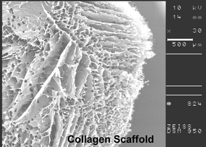 Collagen Scaffold